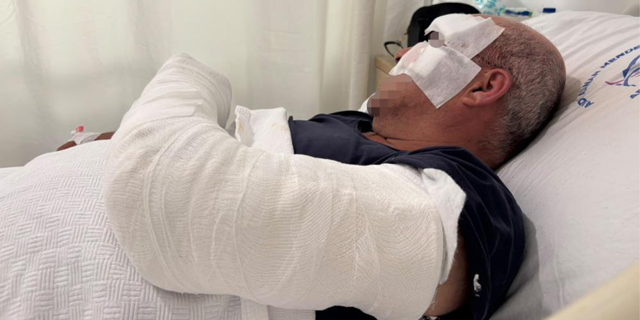 Aydın’da motosiklet kazasında yaralandı: “Kardeşim cip ile bilerek çarptı” iddiası