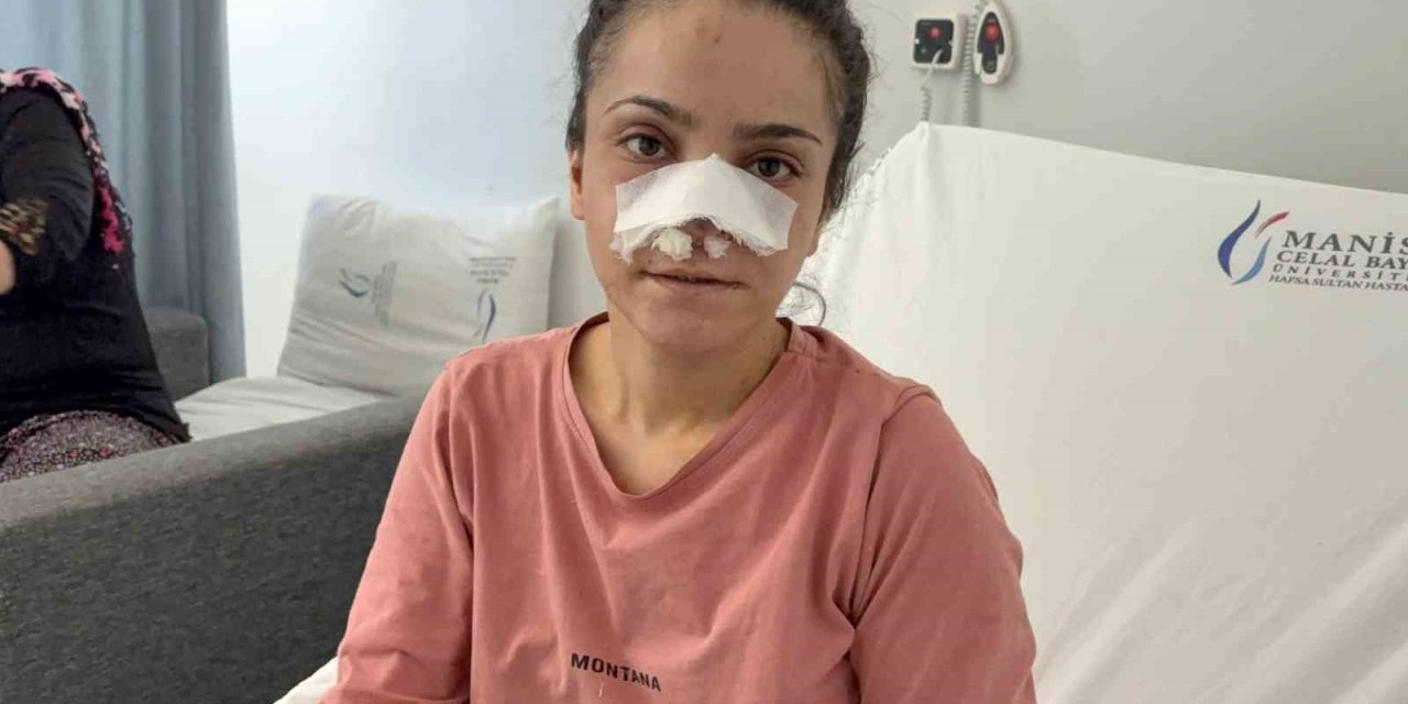 Eşinin kopardığı burnu başarılı operasyonla yerine dikildi