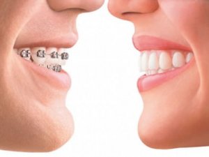 ’Orti’ Çocukların Diş Teli Korkularını Yenmelerini Sağlıyor