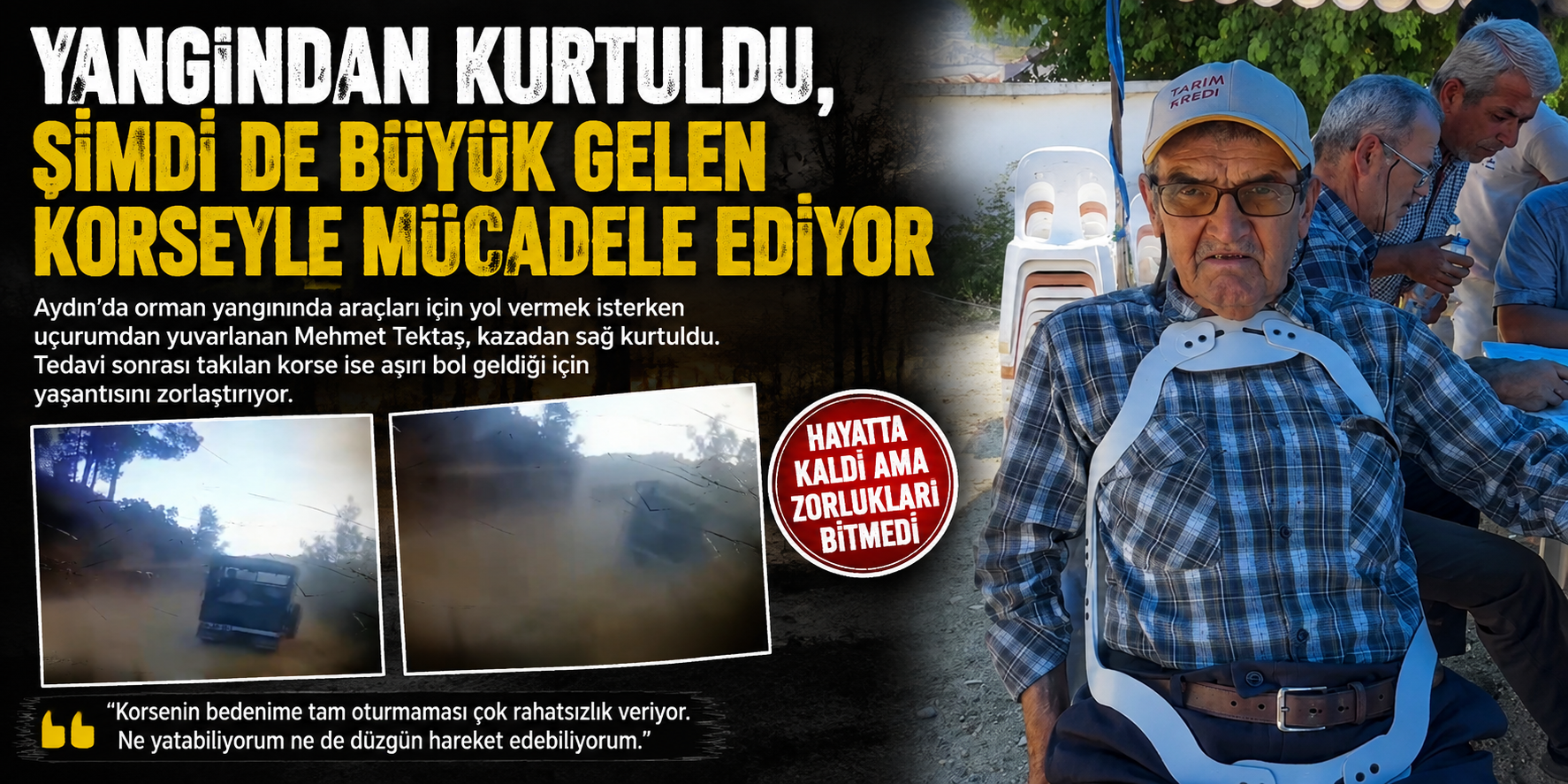 Yangından kurtuldu, şimdi de büyük gelen korseyle mücadele ediyor