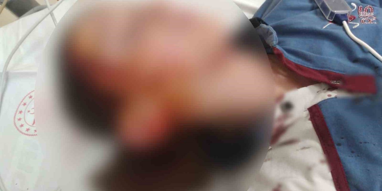 Köpek saldırısında yaralanan çocuk için 1 milyon 200 bin tazminat