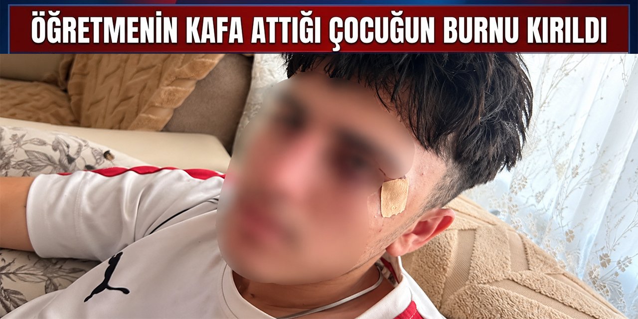 Öğretmenin kafa attığı çocuğun burnu kırıldı