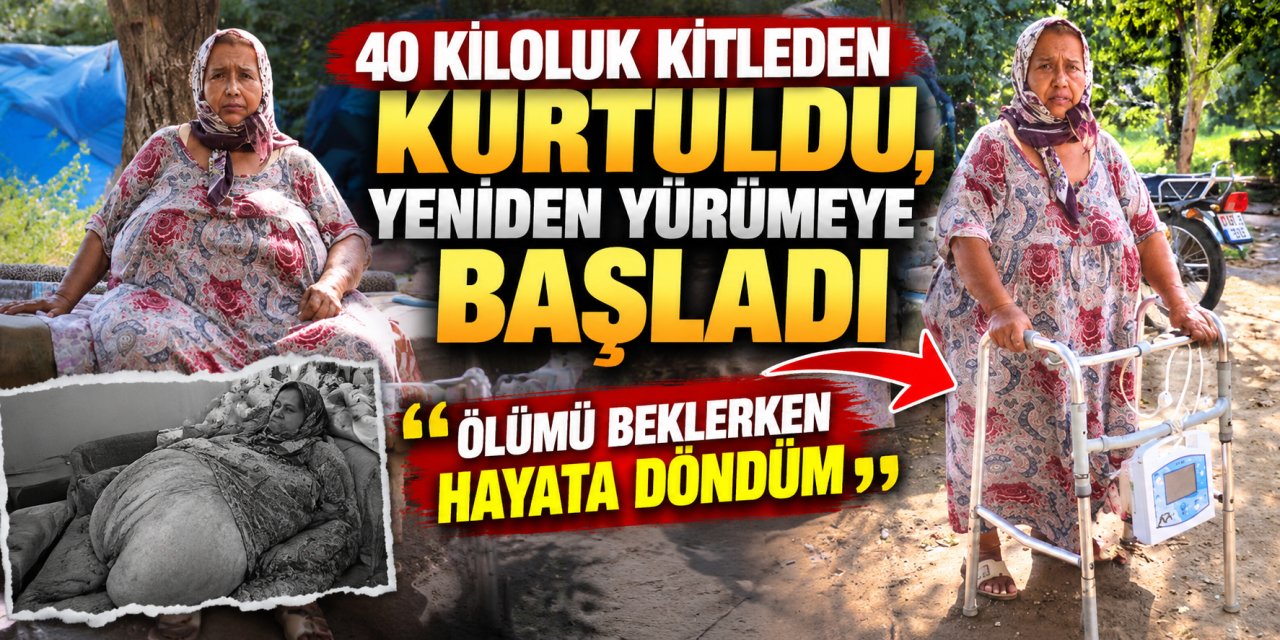 40 kiloluk kitleden kurtuldu, yeniden yürümeye başladı: “Ölümü beklerken hayata döndüm”