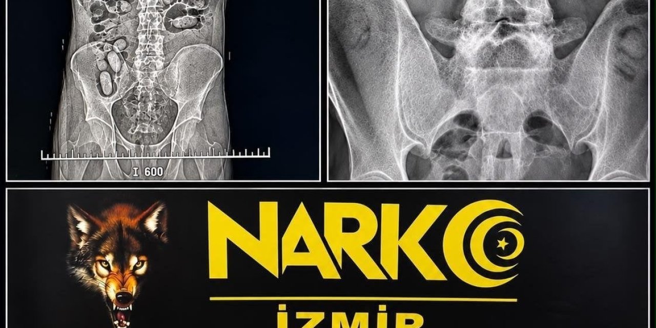 Havalimanında şüpheli yolcuların midesinden uyuşturucu çıktı