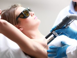 Lazer Epilasyonda Yer Seçimine Dikkat