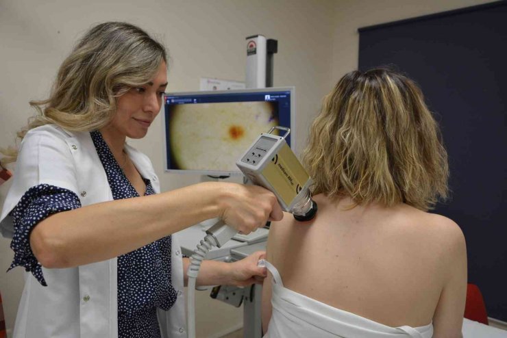 PAÜ Hastanesinden ücretsiz deri kanseri tarama imkanı