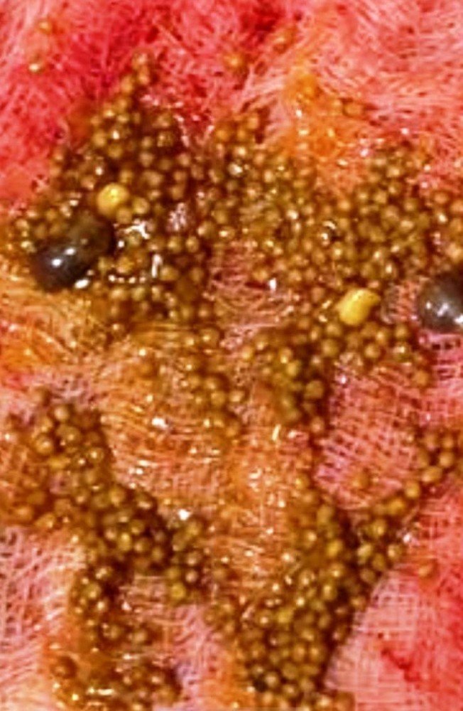 Karnından çıkanlar doktorları bile şaşırttı