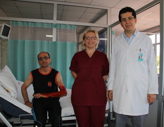 (Özel Haber) Yanan Hastalar Artık Sevk Edilmeyecek